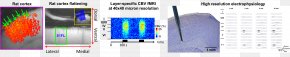 Brain - Functional Magnetic Resonance Imaging Laboratory Neuroimaging Electrophysiology Optogenetics PNG