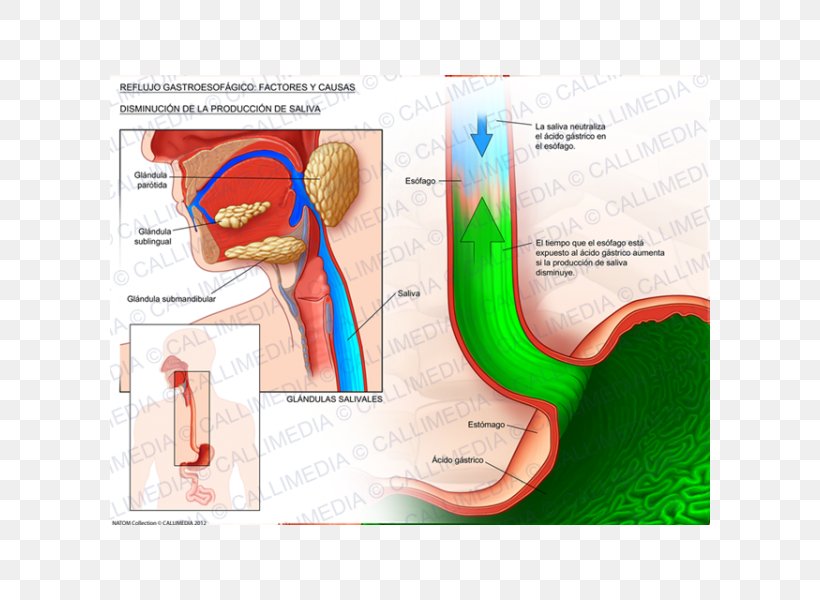 Gastroesophageal Reflux Disease Esophagus Saliva Gastro- Cough, PNG, 600x600px, Watercolor, Cartoon, Flower, Frame, Heart Download Free