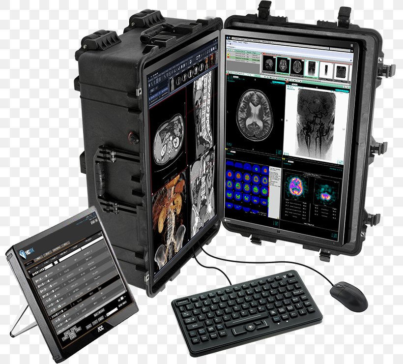 Electronics Radiology Surface-mount Technology, PNG, 800x740px, Electronics, Company, Computer Hardware, Computer Monitors, Electronic Instrument Download Free