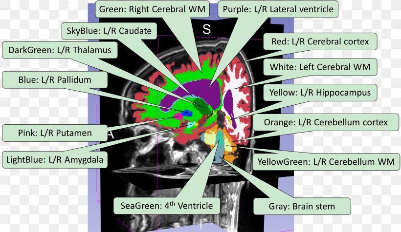 Image Segmentation Graphic Design Brain Implementation, PNG, 2347x1364px, Image Segmentation, Brain, Human Brain, Implementation, Neuroimaging Download Free