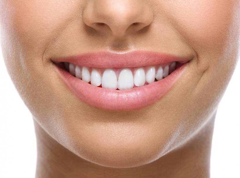 Tooth Whitening Cosmetic Dentistry Smile, PNG, 1110x825px, Tooth Whitening, Beauty, Cheek, Chin, Clear Aligners Download Free