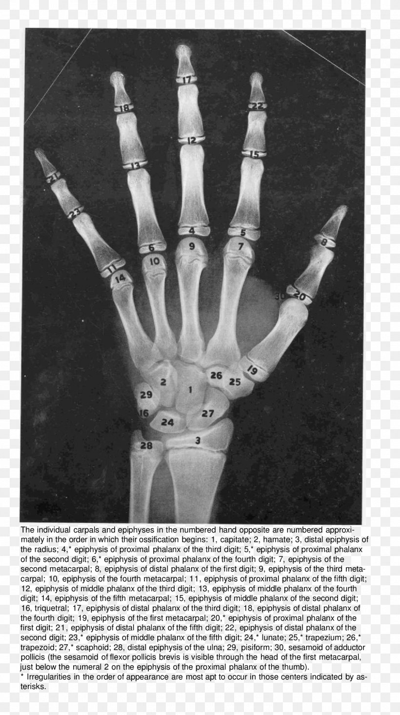 Finger Bone Hand Radiography Anatomy, PNG, 1496x2676px, Finger, Anatomy, Arm, Black And White, Bone Download Free