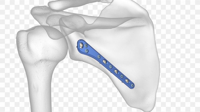Scapula Anatomy Shoulder Glenoid Cavity, PNG, 4000x2250px, Scapula, Anatomy, Body, Bone Fracture, Glenoid Cavity Download Free