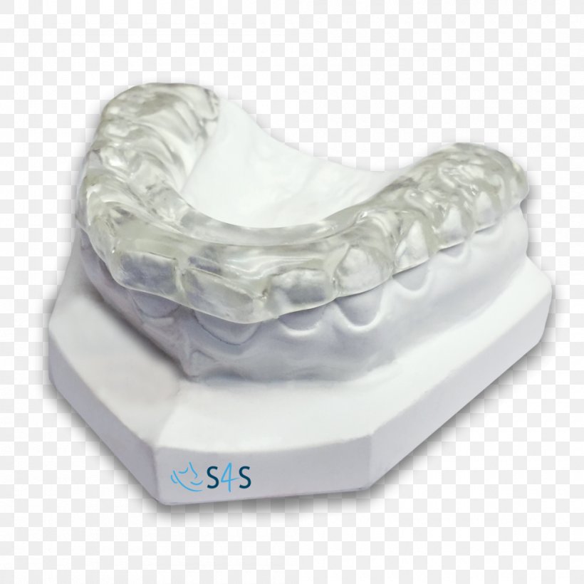 Occlusal Splint Temporomandibular Joint Dysfunction Jaw, PNG, 1000x1000px, Splint, Bed, Bruxism, Comfort, Crown Download Free