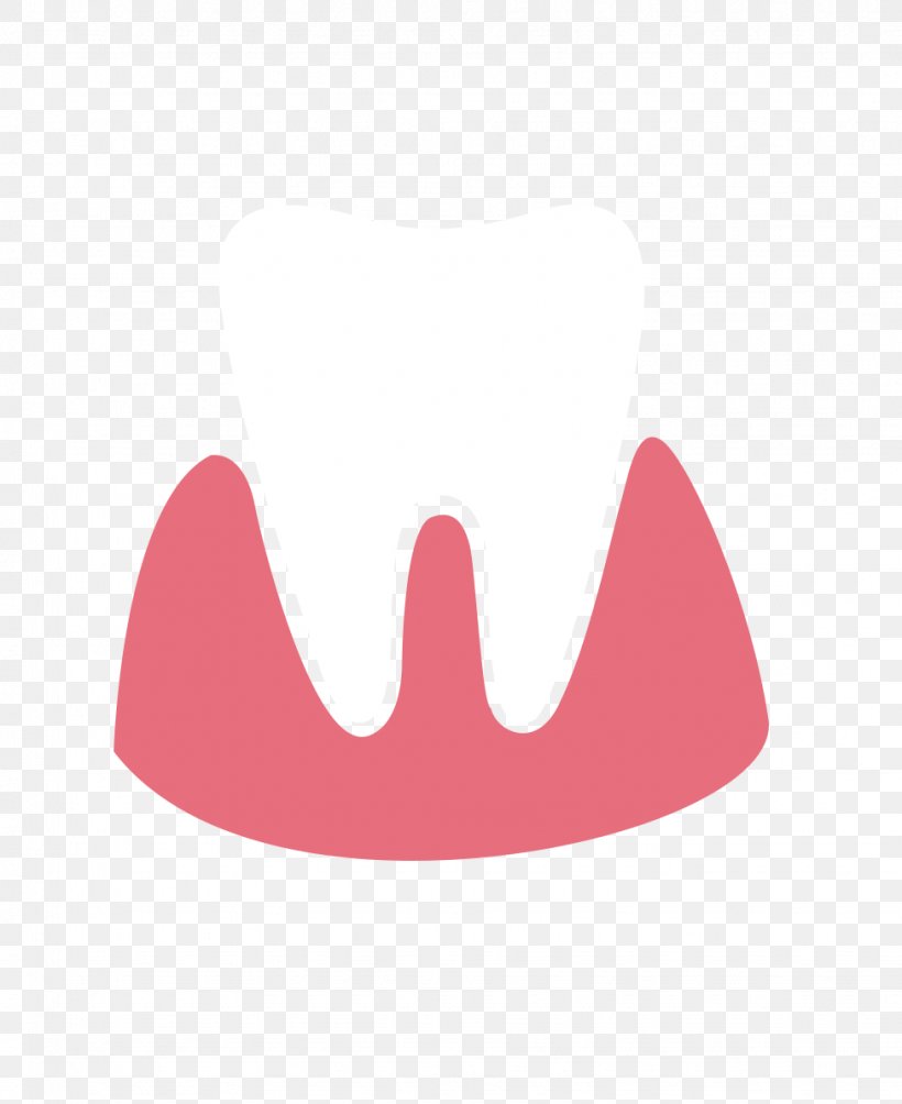 Bleeding On Probing Tooth Decay Gingivitis Gums, PNG, 975x1194px, Bleeding On Probing, Bleeding, Dentistry, Gingivitis, Gum Download Free