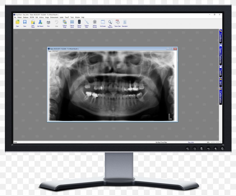 X-ray Vision Dental Radiography Dentistry, PNG, 2168x1804px, Xray Vision, Apteryx Inc, Brand, Computer Monitor, Computer Monitors Download Free