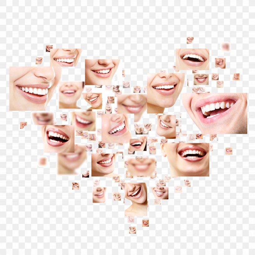Smile Cosmetic Dentistry Tooth, PNG, 5000x5000px, Smile, Cheek, Cosmetic Dentistry, Dental Braces, Dental Implant Download Free