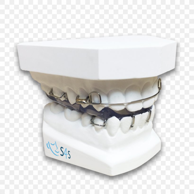 Twin Block Appliance Tooth Orthodontics Dentistry Retainer, PNG, 1000x1000px, Twin Block Appliance, Clark Art Institute, Dentistry, Fulltime, Home Appliance Download Free