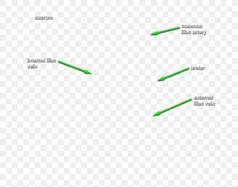 Brand Diagram Line, PNG, 1144x900px, Brand, Area, Diagram, Green, Text Download Free