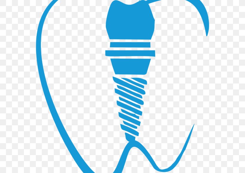 Tooth Dental Implant Dentistry Clip Art, PNG, 580x580px, Tooth, Area, Computed Tomography, Dental Implant, Dentist Download Free