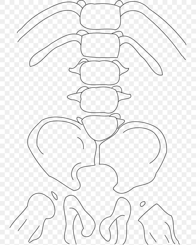 Caudal Regression Syndrome Congenital Heart Defect Birth Defect Genetic Disorder, PNG, 739x1024px, Syndrome, Area, Arm, Artwork, Atresia Download Free