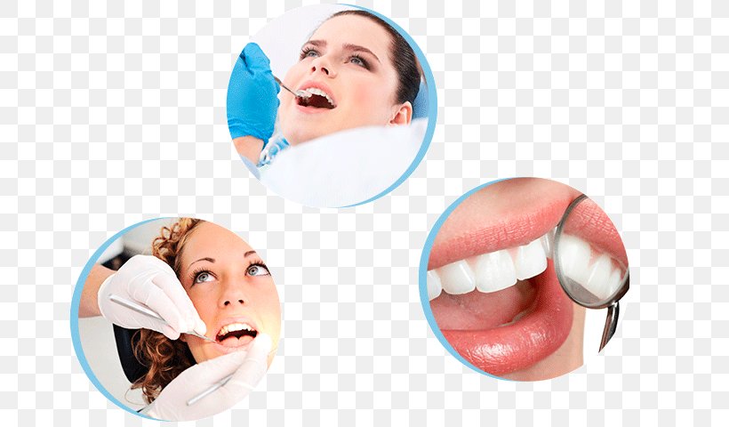 Dentistry Tooth Whitening Dental Implant Endodontic Therapy, PNG, 700x480px, Dentistry, Cheek, Chin, Clinic, Cosmetic Dentistry Download Free