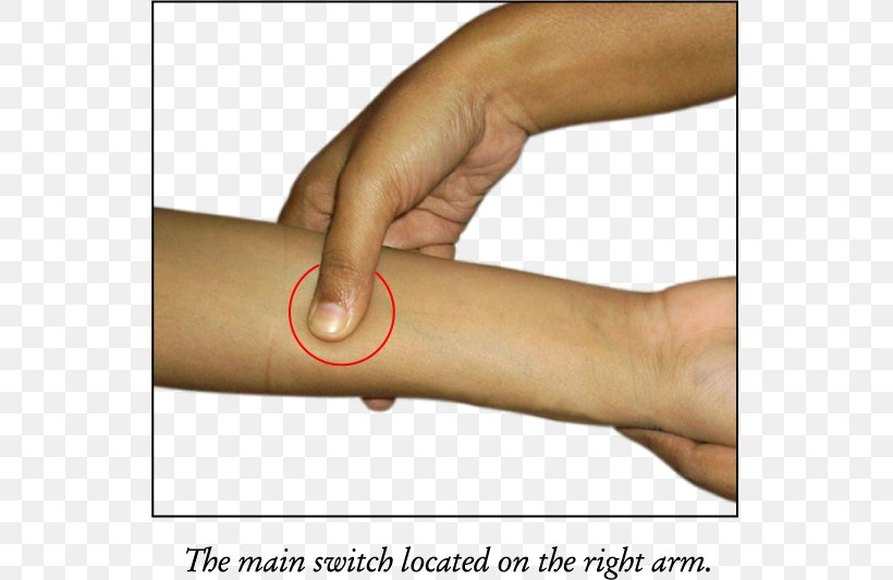 Thumb Acupressure Pressure Point Navel Displacement Acupuncture, PNG, 620x533px, Thumb, Ache, Acupressure, Acupuncture, Adhesive Capsulitis Of Shoulder Download Free