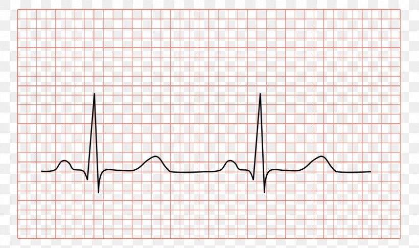 Electrocardiography Heart QRS Complex Sinus Rhythm Sinoatrial Node, PNG, 1280x758px, Watercolor, Cartoon, Flower, Frame, Heart Download Free