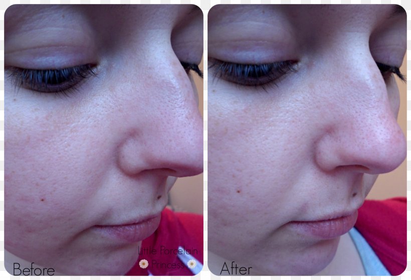 Eyelash Extensions Comedo Facial Nose Sebaceous Filament, PNG, 1600x1090px, Eyelash Extensions, Bb Cream, Cheek, Chin, Close Up Download Free