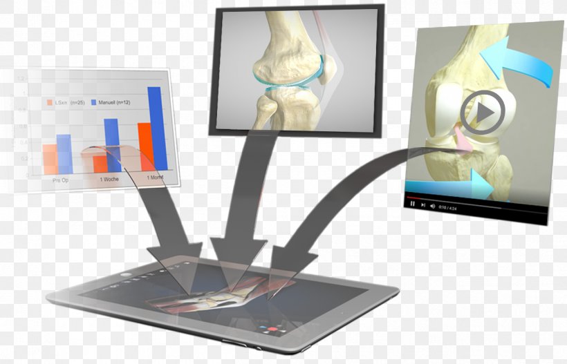 Knee Homo Sapiens Anatomy Effigos AG, PNG, 1251x804px, Knee, Anatomy, Homo Sapiens, Industrial Design, Multimedia Download Free