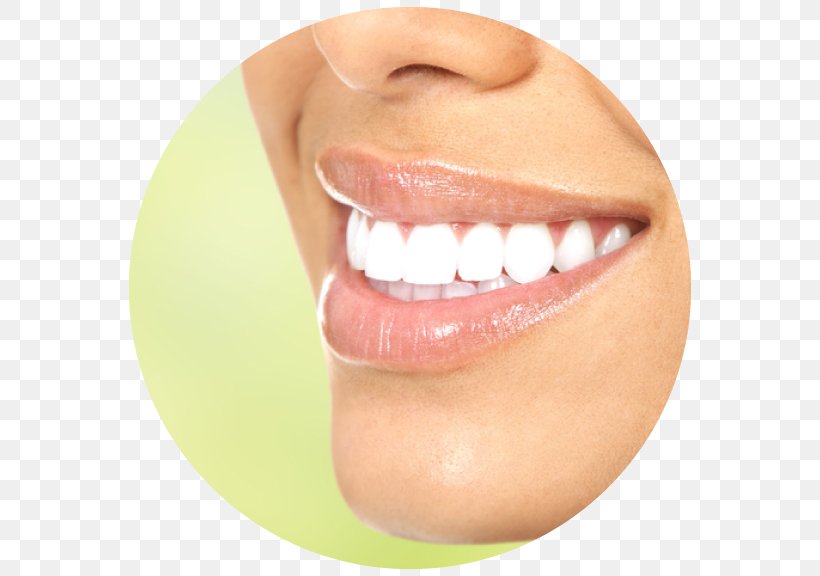Tooth Whitening Cosmetic Dentistry, PNG, 576x576px, Tooth Whitening, Cheek, Chin, Clear Aligners, Close Up Download Free