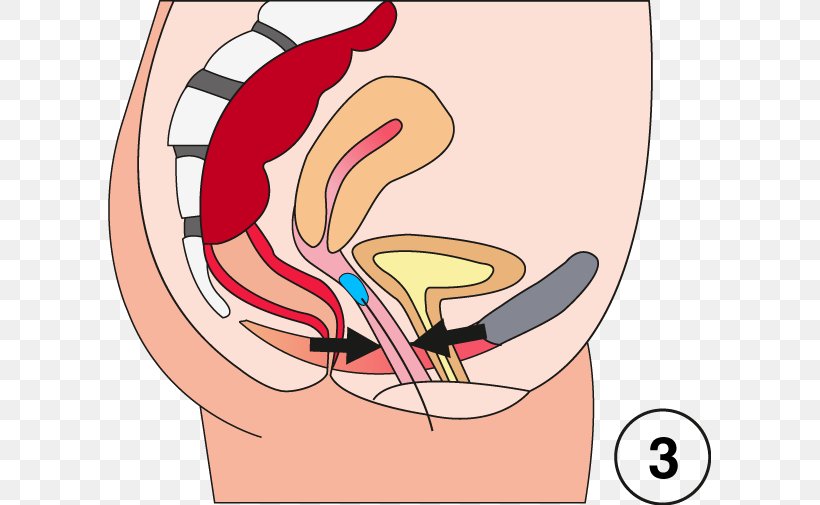 Kegel Exercise Pelvic Floor Muscle Muscular System Thumb, PNG, 603x505px, Watercolor, Cartoon, Flower, Frame, Heart Download Free