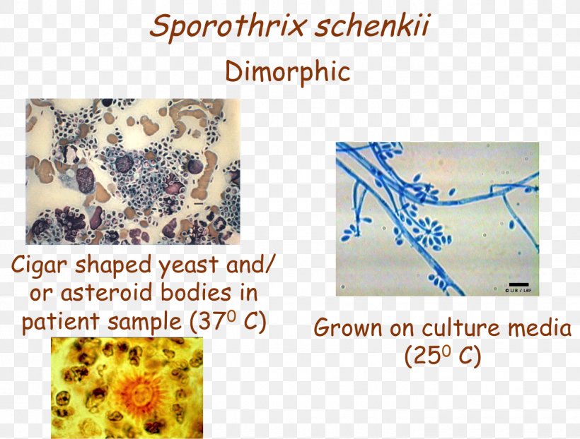 Sporothrix Schenckii Organism, PNG, 1425x1082px, Organism, Text Download Free