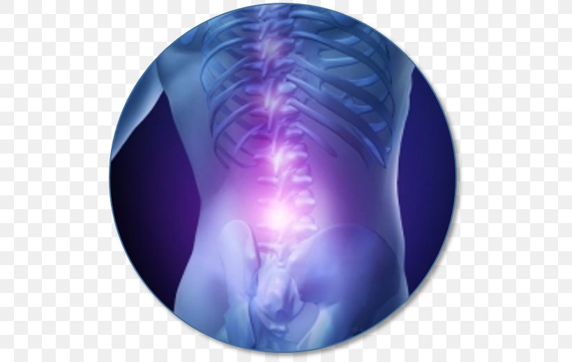 Pain Sacroiliac Back Pain Spinal Disc Herniation Therapy Vertebral Column, PNG, 516x519px, Back Pain, Disease, Ear Pain, Health, Jaw Download Free