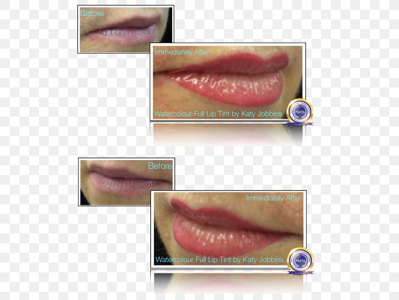 Lip Gloss Close-up, PNG, 531x617px, Lip, Closeup, Eyelash, Jaw, Lip Gloss Download Free