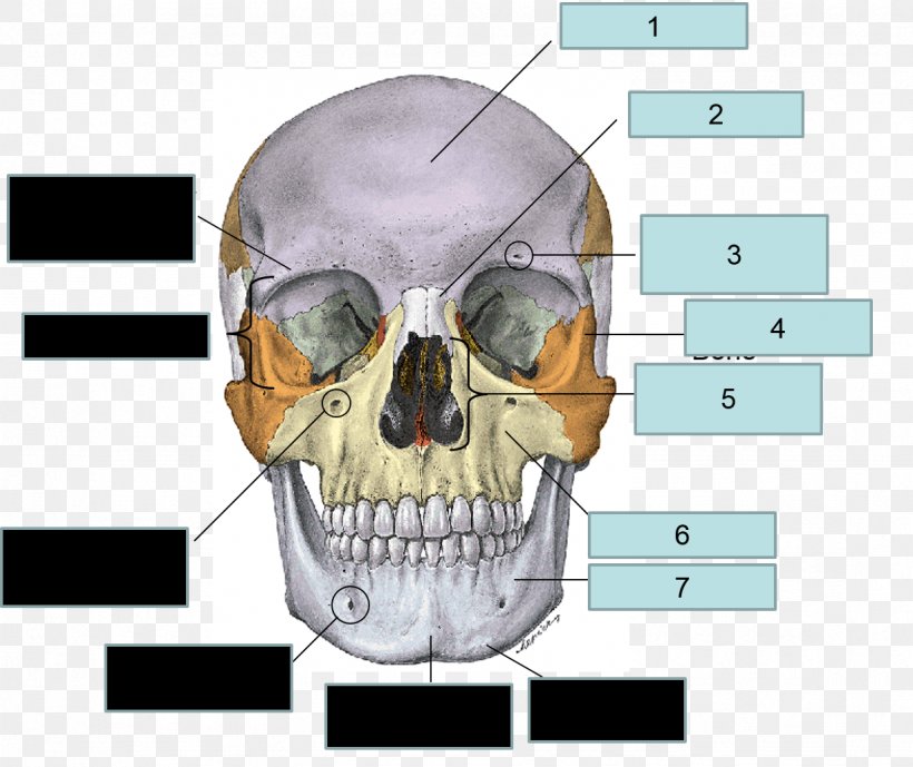 Frontal Bone Sphenoid Bone Human Skull Maxilla, PNG, 1227x1032px, Frontal Bone, Anatomy, Bone, Ethmoid Bone, Face Download Free