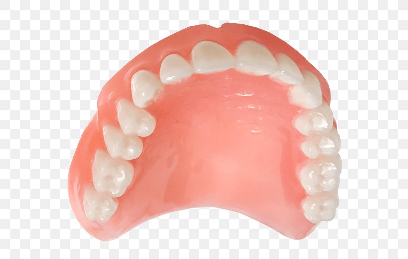 Tooth Dentures Implant Prosthesis Fixfogsor Rendelő, PNG, 600x520px, Tooth, Body, Dentures, Food, Health Download Free