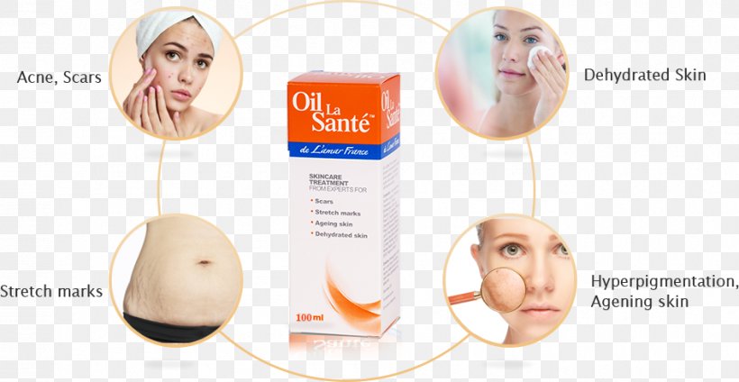 Dryness Oil Health Face Dehydration, PNG, 945x489px, Dryness, Chin, Dehydration, Ear, Face Download Free