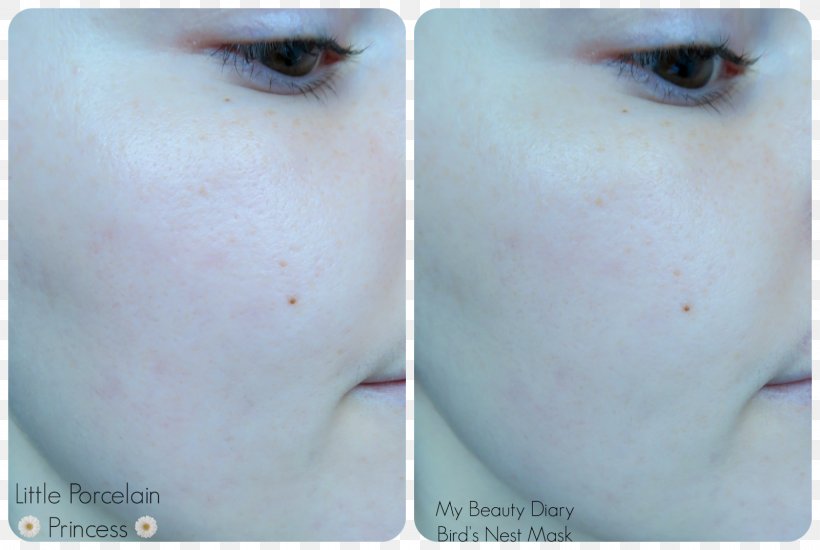 Nose Cheek Chin Eyebrow Forehead, PNG, 1600x1075px, Nose, Cheek, Chin, Close Up, Closeup Download Free