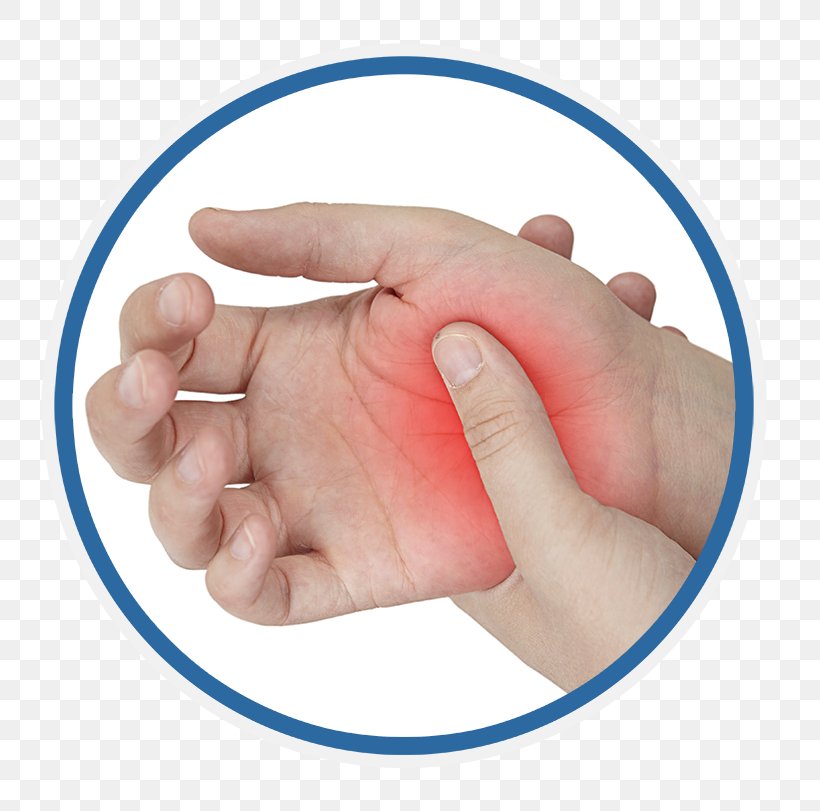 Hand Pain Hypoesthesia Rheumatoid Arthritis, PNG, 800x811px, Watercolor, Cartoon, Flower, Frame, Heart Download Free