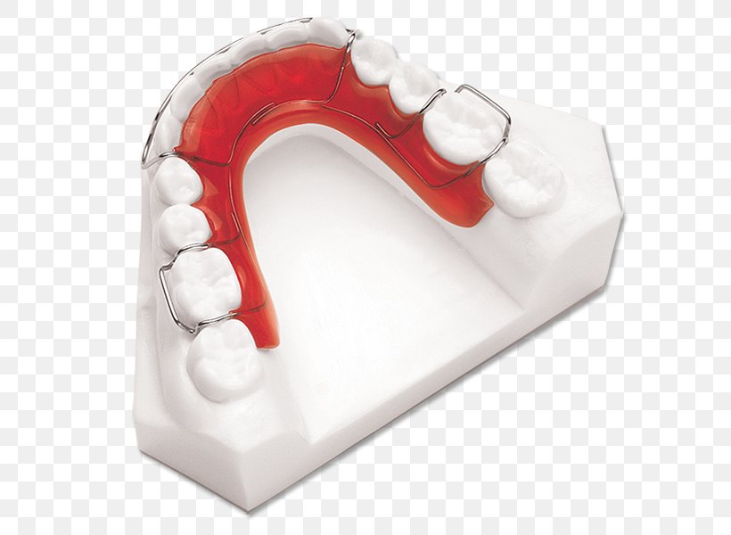 Retainer Jaw Orthodontics Mandible Tooth, PNG, 597x600px, Retainer, Adviser, Cost, Fee, Investopedia Download Free