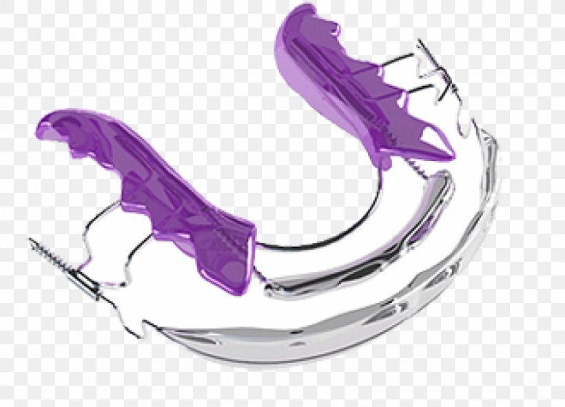 Clear Aligners Dental Braces Cosmetic Dentistry Orthodontics, PNG, 970x700px, Clear Aligners, Clinic, Cosmetic Dentistry, Dental Braces, Dental Implant Download Free