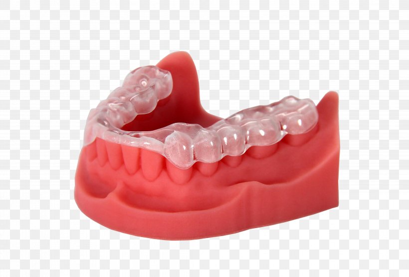 3D Printing Dentistry Stratasys Printer, PNG, 4337x2940px, 3d Printing, Acrylonitrile Butadiene Styrene, Dentistry, Envisiontec, Industry Download Free