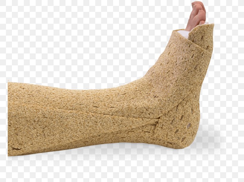 Occupational Therapy Bahan Orthopedic Cast Wood Splint, PNG, 768x613px, Occupational Therapy, Bahan, Beige, Biology, Bone Fracture Download Free