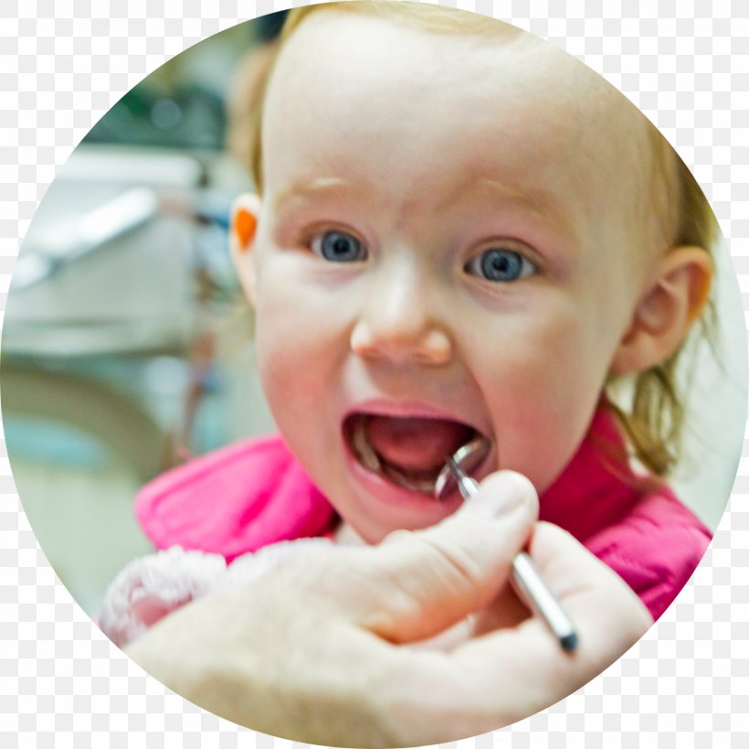 Pediatric Dentistry Pediatrics Dental College, PNG, 1600x1600px, Dentistry, Cheek, Child, Cosmetic Dentistry, Dental College Download Free