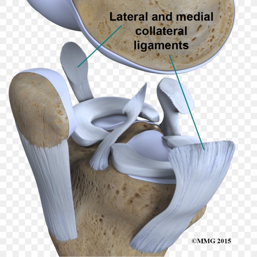 Joint Knee Anterior Cruciate Ligament Injury, PNG, 1024x1024px, Joint, Anterior Cruciate Ligament, Anterior Cruciate Ligament Injury, Articular Cartilage Damage, Bone Download Free