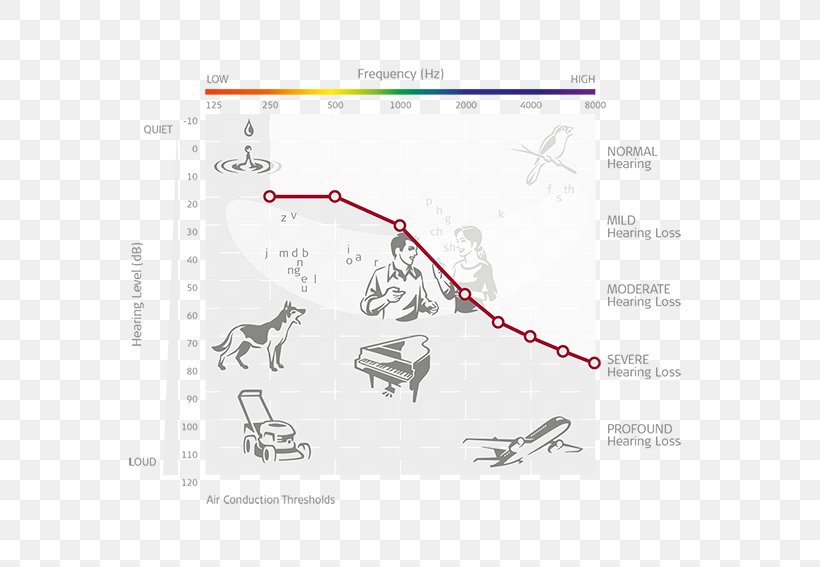 Cochlear Implant Audiometry Audiogram MED-EL Hearing Loss, PNG, 567x567px, Cochlear Implant, Area, Audiogram, Audiologist, Audiometry Download Free