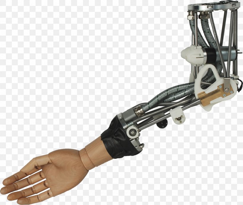 Robotic Arm Prosthesis Bionics, PNG, 1420x1197px, Robotic Arm, Arm, Articulated Robot, Bionics, Cybernetics Download Free