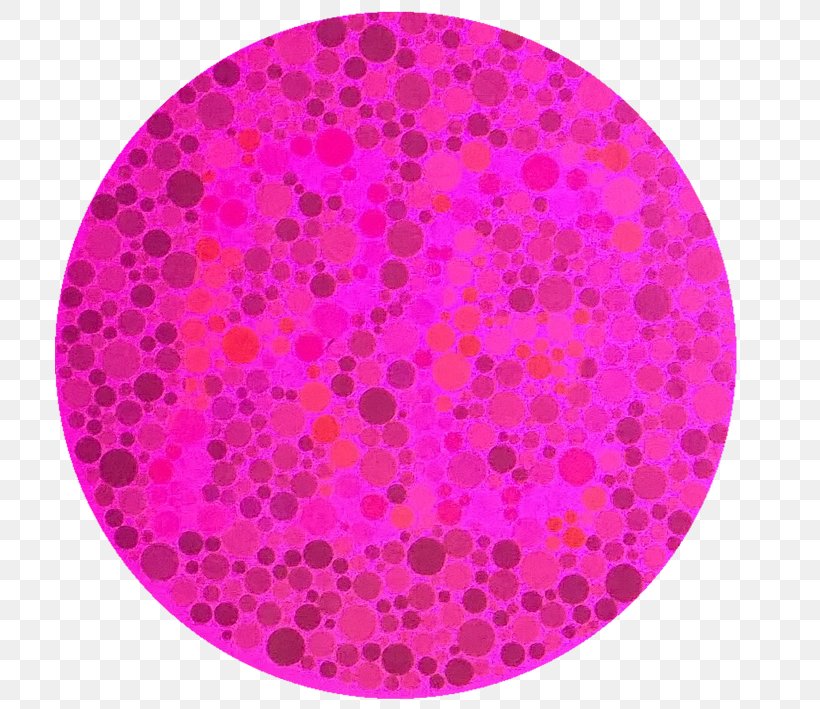 Color Blindness Color Vision Visual Perception Comma, PNG, 709x709px, Color Blindness, Color, Color Vision, Comma, Dash Download Free