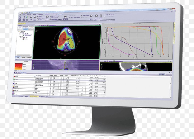 Radiation Therapy Radiation Treatment Planning Surgery Patient, PNG, 800x588px, Therapy, Cancer, Computer Monitor, Computer Monitors, Display Device Download Free