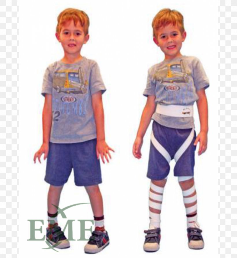 Orthotics Splint Therapy Reciprocating Gait Orthosis, PNG, 917x1000px, Orthotics, Abdomen, Boy, Cerebral Palsy, Cervical Collar Download Free