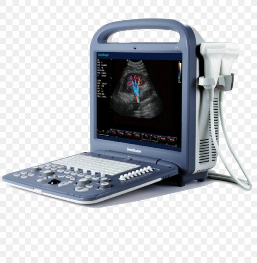 Doppler Echocardiography Portable Ultrasound Ultrasonography SonoScape Medical Corp, PNG, 977x1000px, 3d Ultrasound, Doppler Echocardiography, Communication, Doppler Fetal Monitor, Echocardiography Download Free