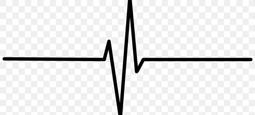 Heart Rate Electrocardiography Pulse Clip Art, PNG, 804x369px, Heart Rate, Black And White, Drawing, Electrocardiography, Flatline Download Free