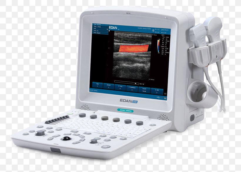 Edan USA Diagnostic Ultrasound Ultrasonography Medical Imaging, PNG, 800x585px, Edan Usa, Communication, Diagnostic Ultrasound, Doppler Echocardiography, Doppler Ultrasonography Download Free