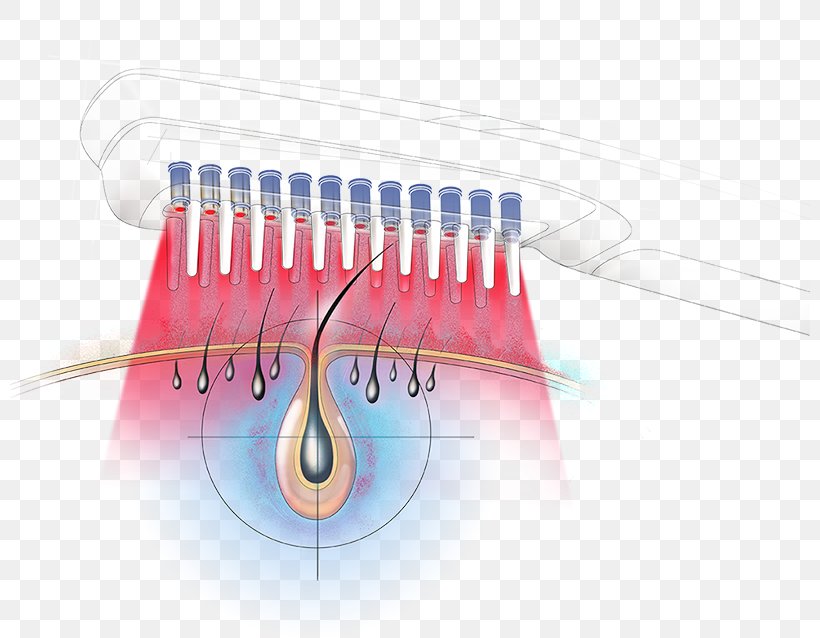Comb Laser Diode Hair Brush, PNG, 800x638px, Comb, Brush, Diode, Hair, Hair Follicle Download Free