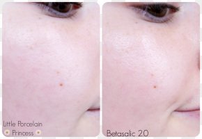 Nose - Cheek Chin Forehead Eyebrow Eyelash PNG