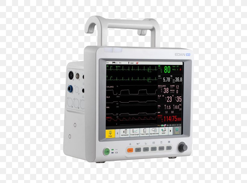 Monitoring Computer Monitors Capnography Pulse Oximetry Touchscreen, PNG, 709x610px, Monitoring, Automated External Defibrillators, Capnography, Computer Monitors, Display Device Download Free