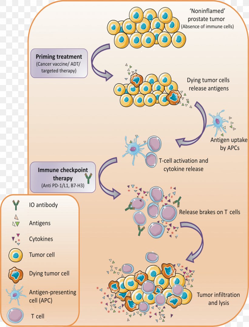 Prostate Cancer Checkpoint Inhibitor Therapy Immune Checkpoint Abiraterone Acetate, PNG, 1148x1509px, Prostate Cancer, Abiraterone Acetate, Antiandrogen, Area, Checkpoint Inhibitor Download Free