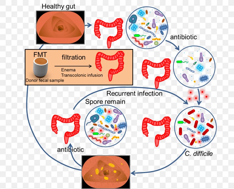 Fecal Microbiota Transplant Feces Ulcerative Colitis Gut Flora Faecal Calprotectin, PNG, 700x662px, Watercolor, Cartoon, Flower, Frame, Heart Download Free