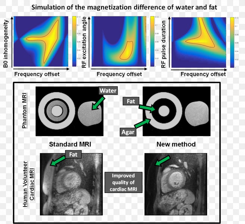 Medical Imaging Cardiac Magnetic Resonance Imaging Cardiology Thesis, PNG, 1080x989px, Medical Imaging, Cardiac Magnetic Resonance Imaging, Cardiology, Coronary Ct Angiography, Essay Download Free